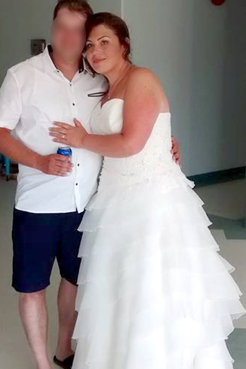 Patients 20-39 Years Old Before & After Gallery - Patient 14494360 - Image 2