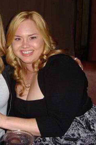 Patients 20-39 Years Old Before & After Gallery - Patient 14494384 - Image 1