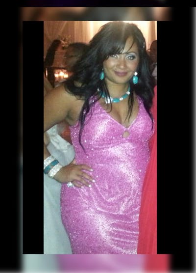 Patients 20-39 Years Old Before & After Gallery - Patient 14494385 - Image 1