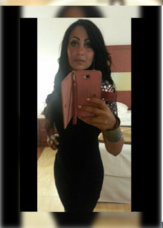 Patients 20-39 Years Old Before & After Gallery - Patient 14494385 - Image 2