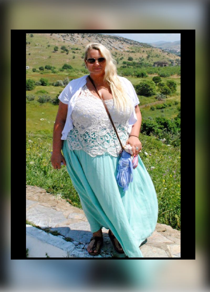 Patients 20-39 Years Old Before & After Gallery - Patient 14494386 - Image 1