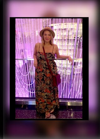 Patients 20-39 Years Old Before & After Gallery - Patient 14494386 - Image 2