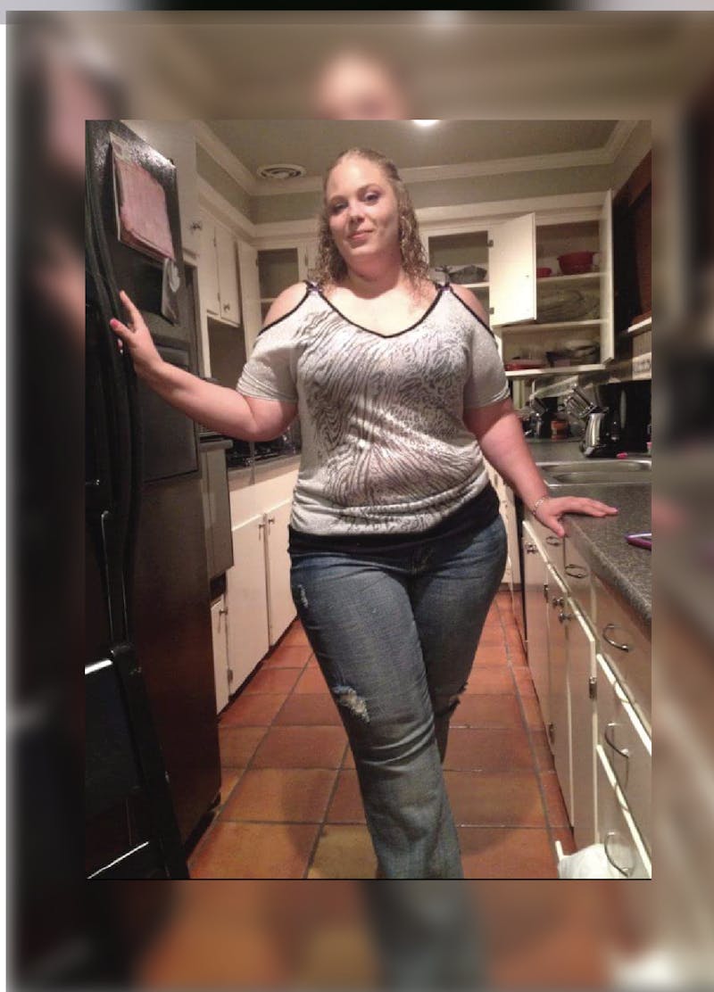 Patients 20-39 Years Old Before & After Gallery - Patient 14494387 - Image 1