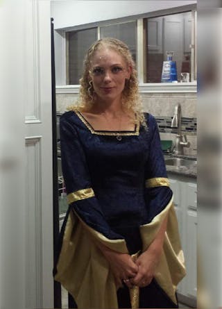 Patients 20-39 Years Old Before & After Gallery - Patient 14494387 - Image 2