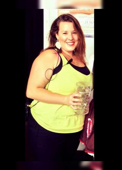 Patients 20-39 Years Old Before & After Gallery - Patient 14494388 - Image 1