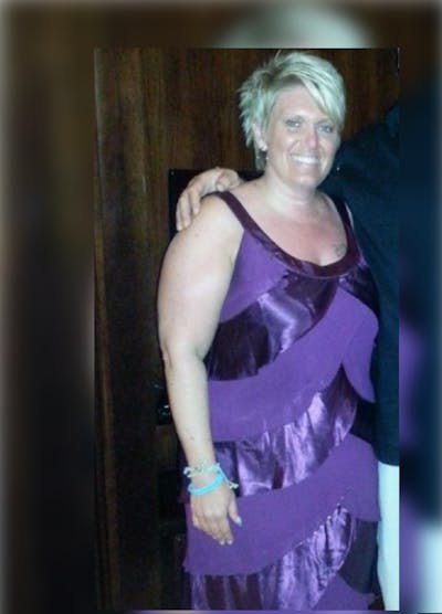 Patients 20-39 Years Old Before & After Gallery - Patient 14494389 - Image 1