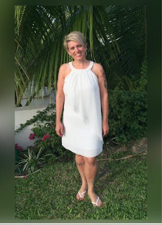 Patients 20-39 Years Old Before & After Gallery - Patient 14494389 - Image 2