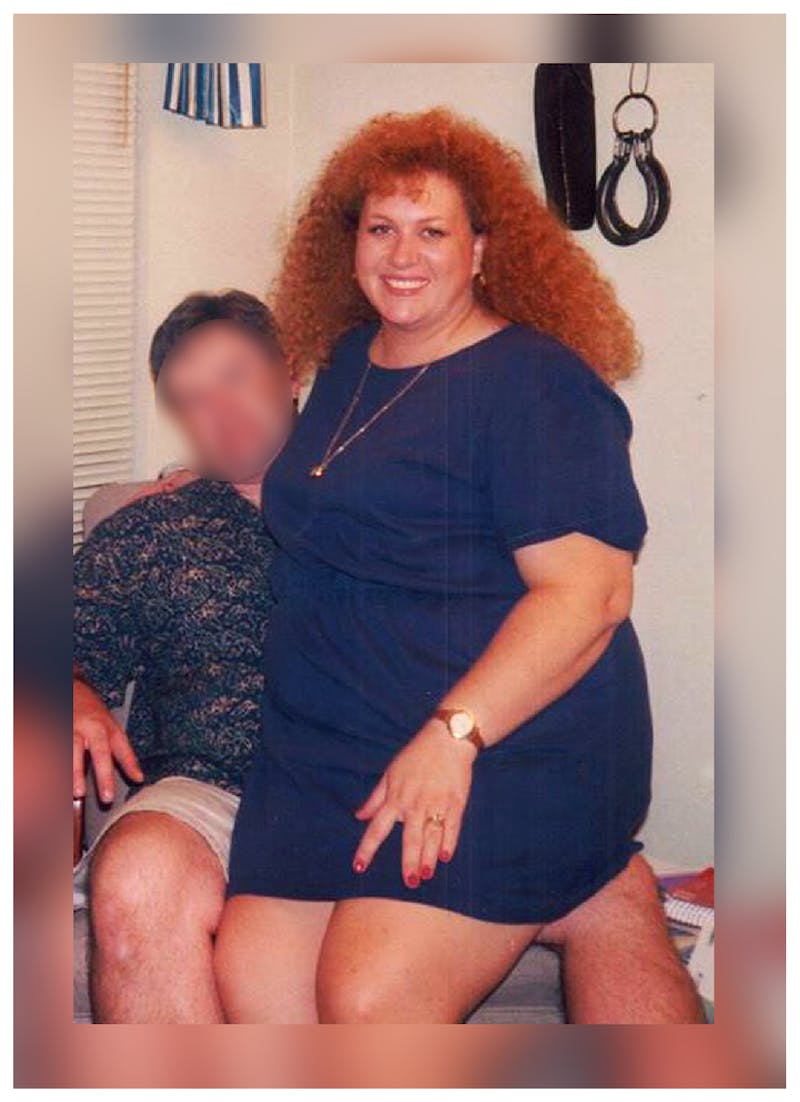 Patients 20-39 Years Old Before & After Gallery - Patient 14494391 - Image 1