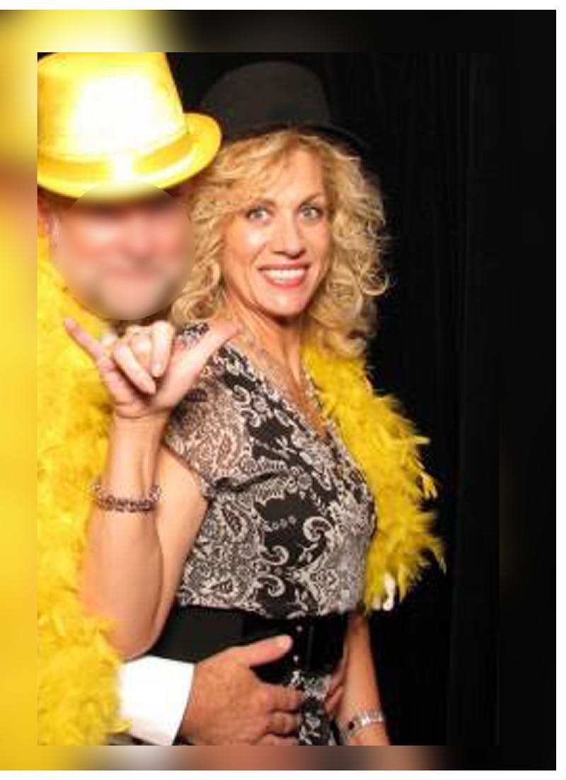 Patients 20-39 Years Old Before & After Gallery - Patient 14494391 - Image 2