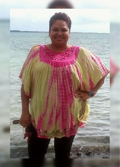 Patients 20-39 Years Old Before & After Gallery - Patient 14494392 - Image 1