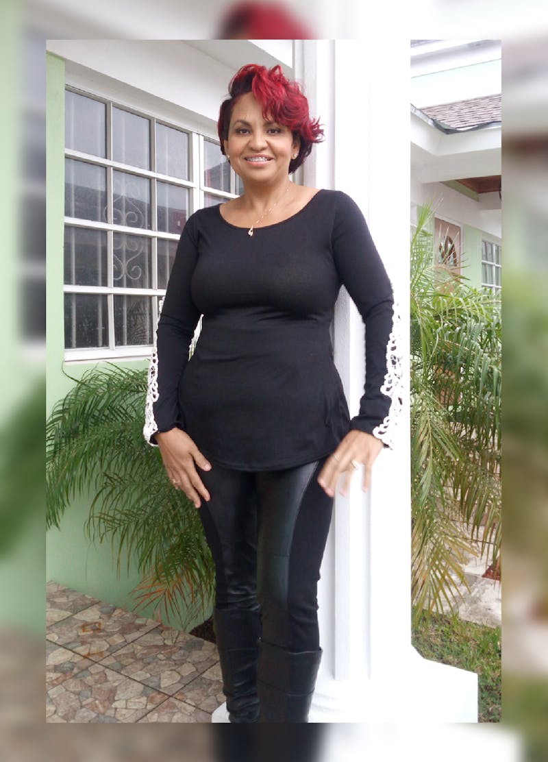 Patients 20-39 Years Old Before & After Gallery - Patient 14494392 - Image 2