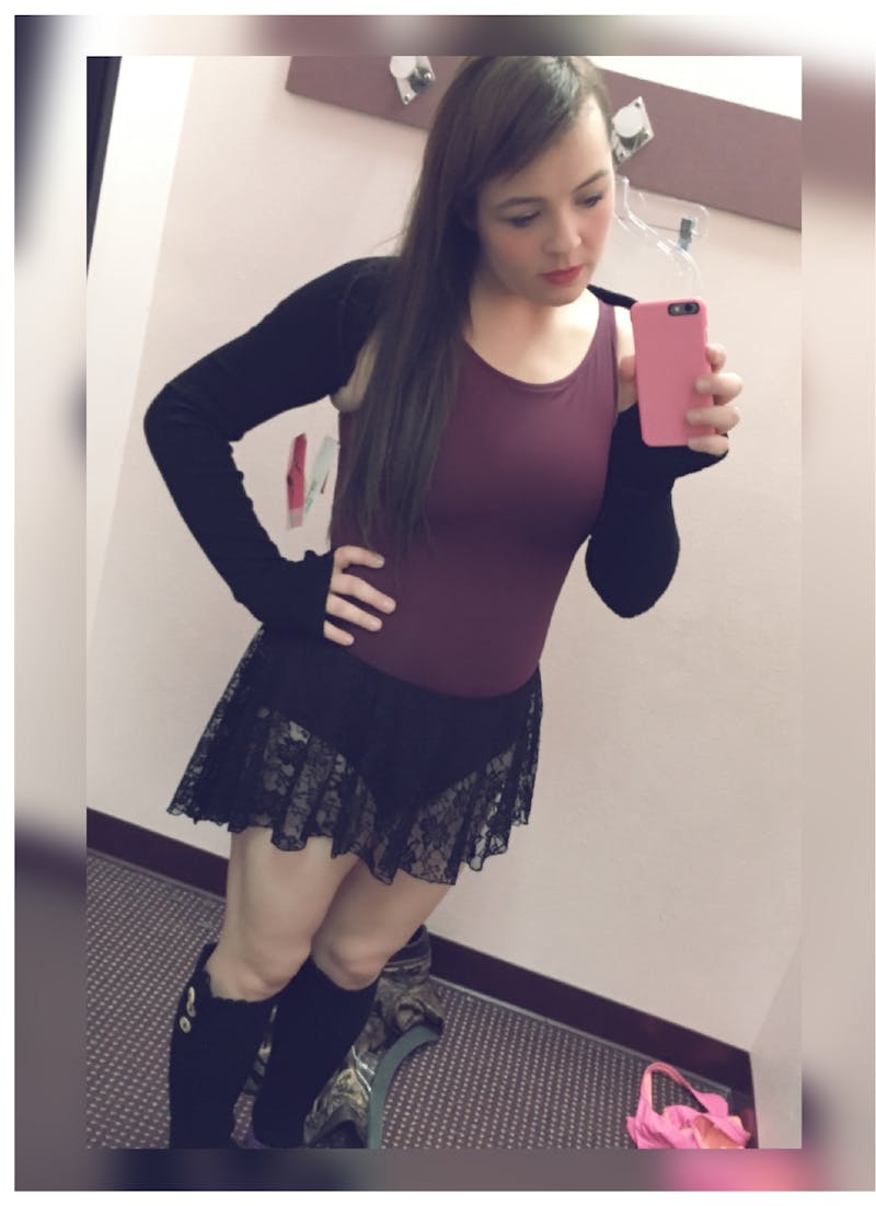 Patients 20-39 Years Old Before & After Gallery - Patient 14494393 - Image 2