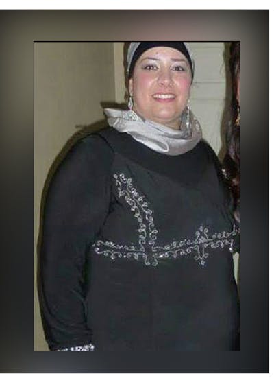 Patients 20-39 Years Old Before & After Gallery - Patient 14494394 - Image 1