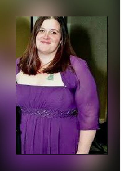 Patients 20-39 Years Old Before & After Gallery - Patient 14494398 - Image 1