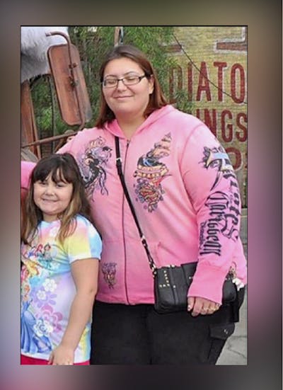 Patients 20-39 Years Old Before & After Gallery - Patient 14494404 - Image 1