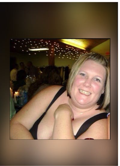 Patients 20-39 Years Old Before & After Gallery - Patient 14494408 - Image 1