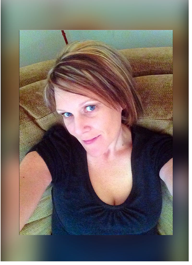 Patients 20-39 Years Old Before & After Gallery - Patient 14494408 - Image 2