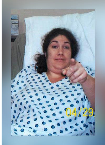 Patients 20-39 Years Old Before & After Gallery - Patient 14494409 - Image 1