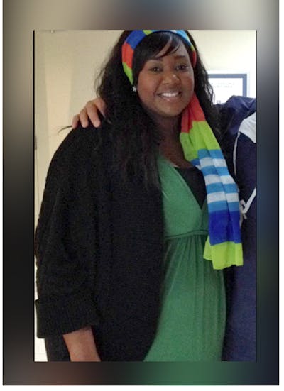 Patients 20-39 Years Old Before & After Gallery - Patient 14494410 - Image 1