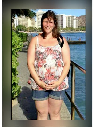 Patients 20-39 Years Old Before & After Gallery - Patient 14494411 - Image 1