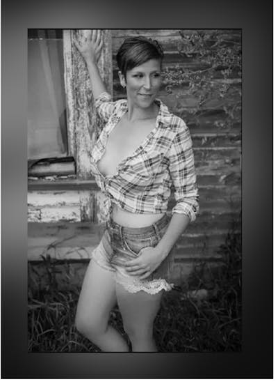 Patients 20-39 Years Old Before & After Gallery - Patient 14494411 - Image 2
