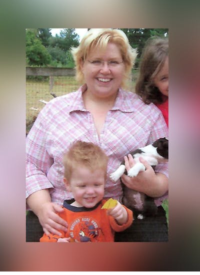 Patients 20-39 Years Old Before & After Gallery - Patient 14494417 - Image 1