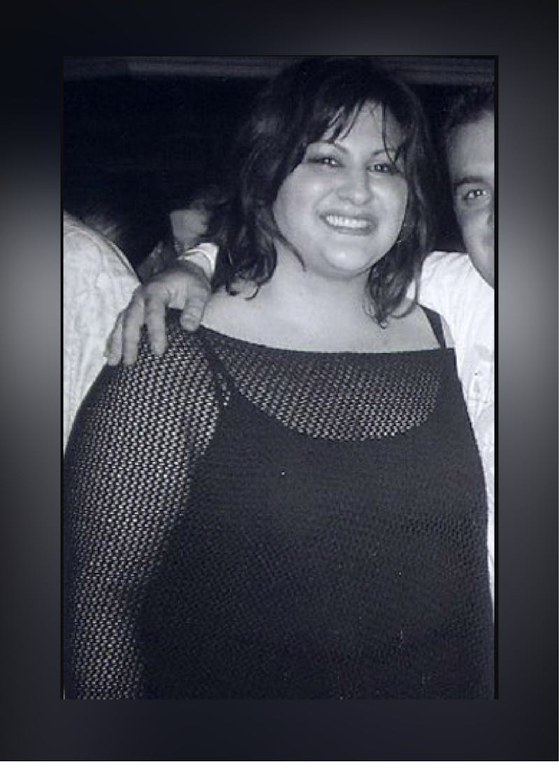 Patients 20-39 Years Old Before & After Gallery - Patient 14494418 - Image 1