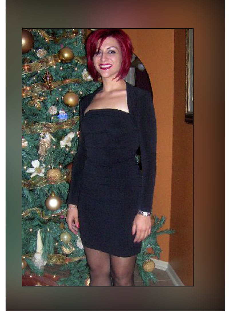 Patients 20-39 Years Old Before & After Gallery - Patient 14494418 - Image 2