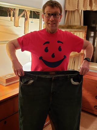 Patients 40-59 Years Old Before & After Gallery - Patient 14494443 - Image 2