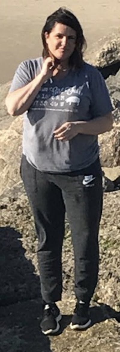 Patients 40-59 Years Old Before & After Gallery - Patient 14494444 - Image 1