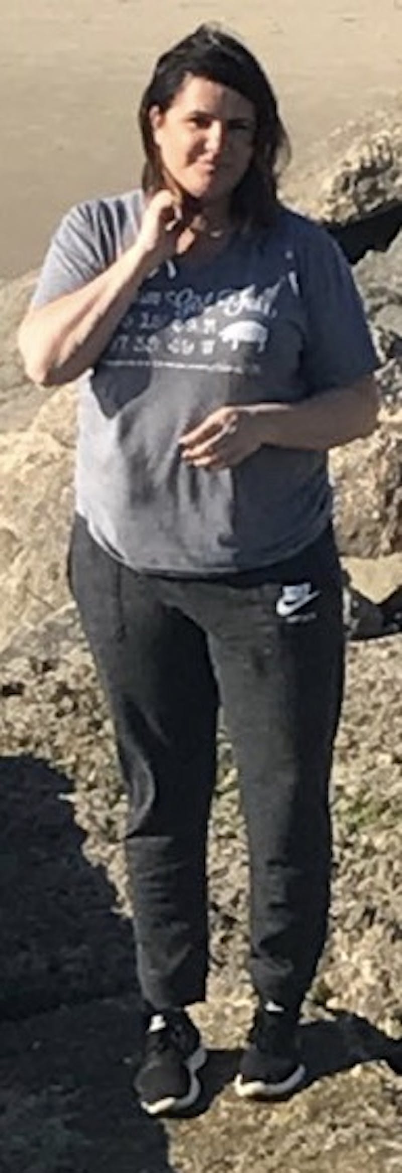 Patients 40-59 Years Old Before & After Gallery - Patient 14494444 - Image 1