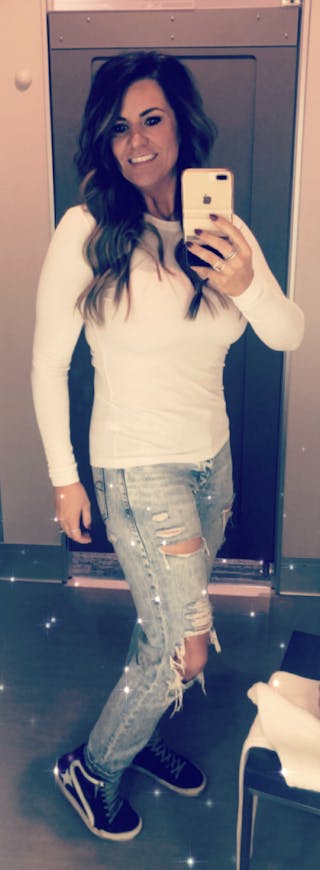 Patients 40-59 Years Old Before & After Gallery - Patient 14494444 - Image 2