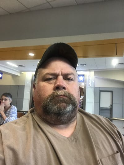 Patients 40-59 Years Old Before & After Gallery - Patient 14494445 - Image 1