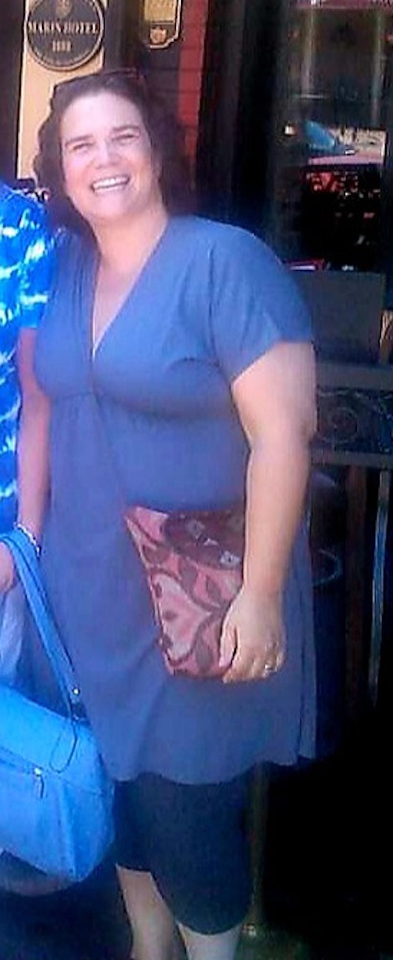 Patients 40-59 Years Old Before & After Gallery - Patient 14494446 - Image 1