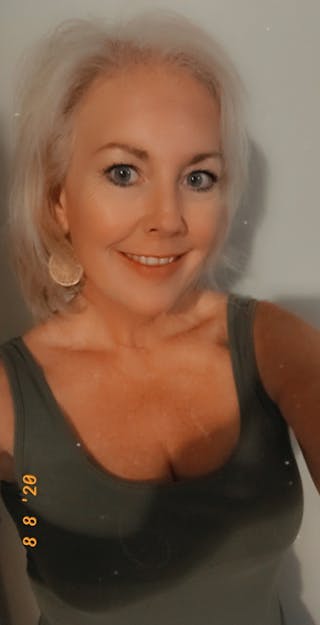 Patients 40-59 Years Old Before & After Gallery - Patient 14494447 - Image 2