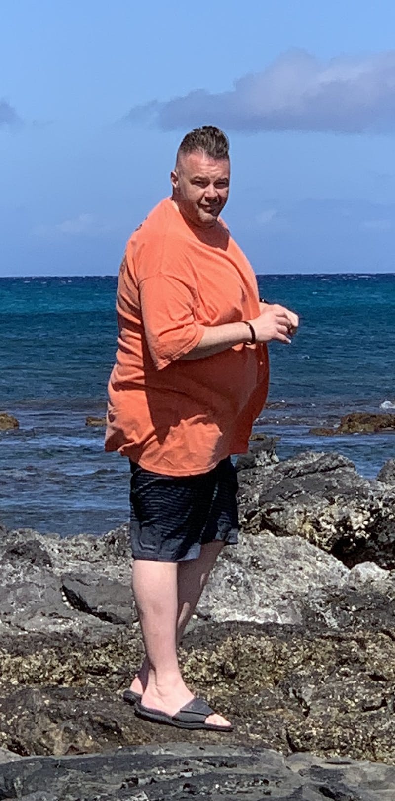 Patients 40-59 Years Old Before & After Gallery - Patient 14494448 - Image 1