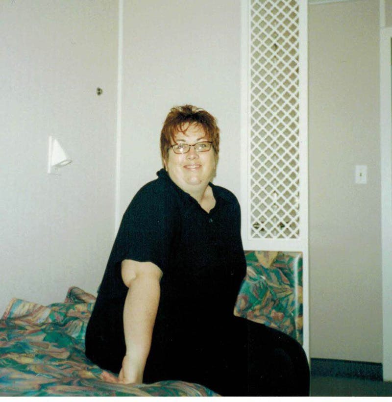 Patients 40-59 Years Old Before & After Gallery - Patient 14494451 - Image 1