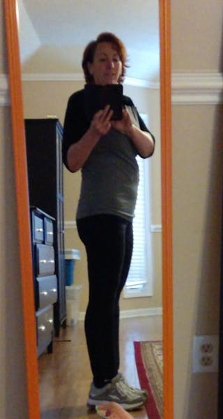 Patients 40-59 Years Old Before & After Gallery - Patient 14494451 - Image 2