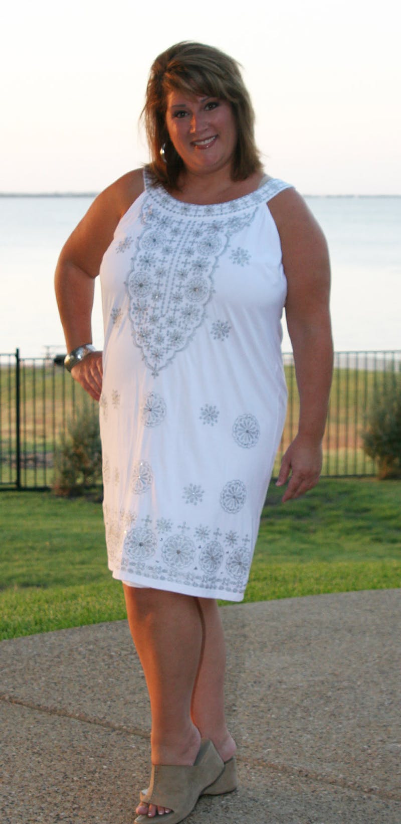 Patients 40-59 Years Old Before & After Gallery - Patient 14494452 - Image 1