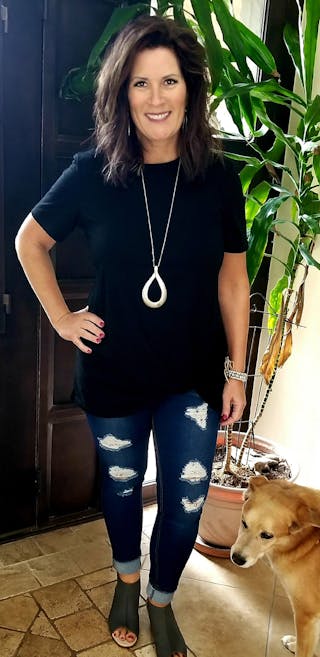 Patients 40-59 Years Old Before & After Gallery - Patient 14494452 - Image 2