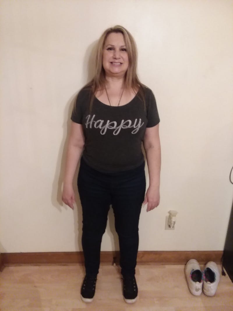 Patients 40-59 Years Old Before & After Gallery - Patient 14494453 - Image 2