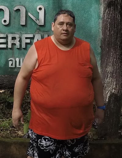 Patients 40-59 Years Old Before & After Gallery - Patient 14494454 - Image 1