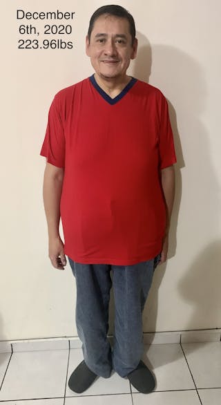 Patients 40-59 Years Old Before & After Gallery - Patient 14494454 - Image 2