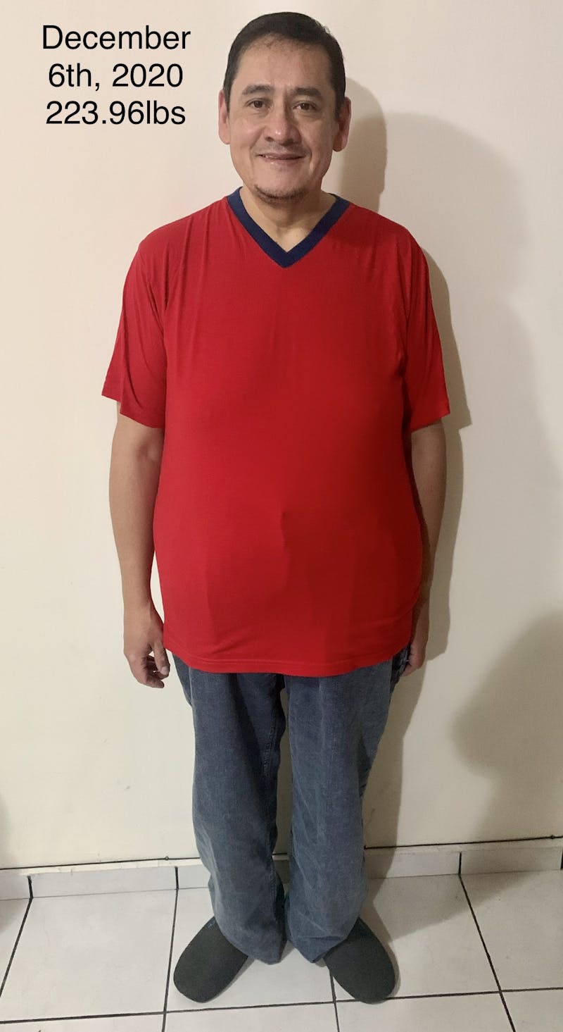 Patients 40-59 Years Old Before & After Gallery - Patient 14494454 - Image 2