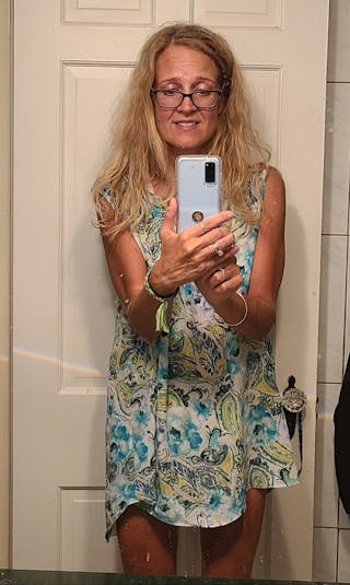 Patients 40-59 Years Old Before & After Gallery - Patient 14494455 - Image 2