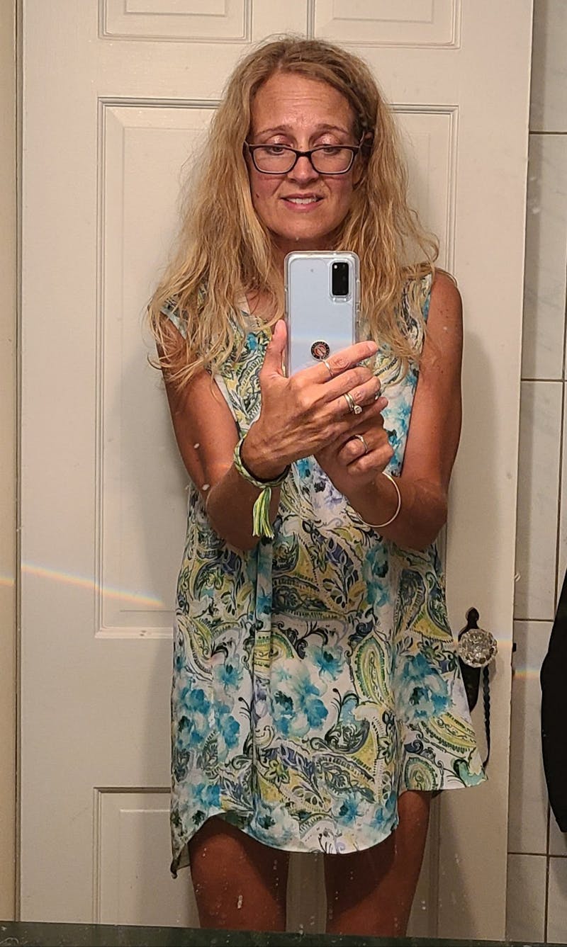 Patients 40-59 Years Old Before & After Gallery - Patient 14494455 - Image 2