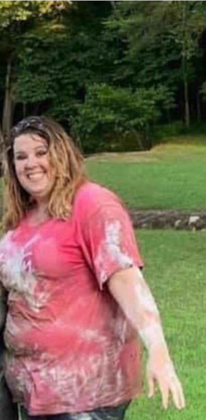 Patients 40-59 Years Old Before & After Gallery - Patient 14494458 - Image 1