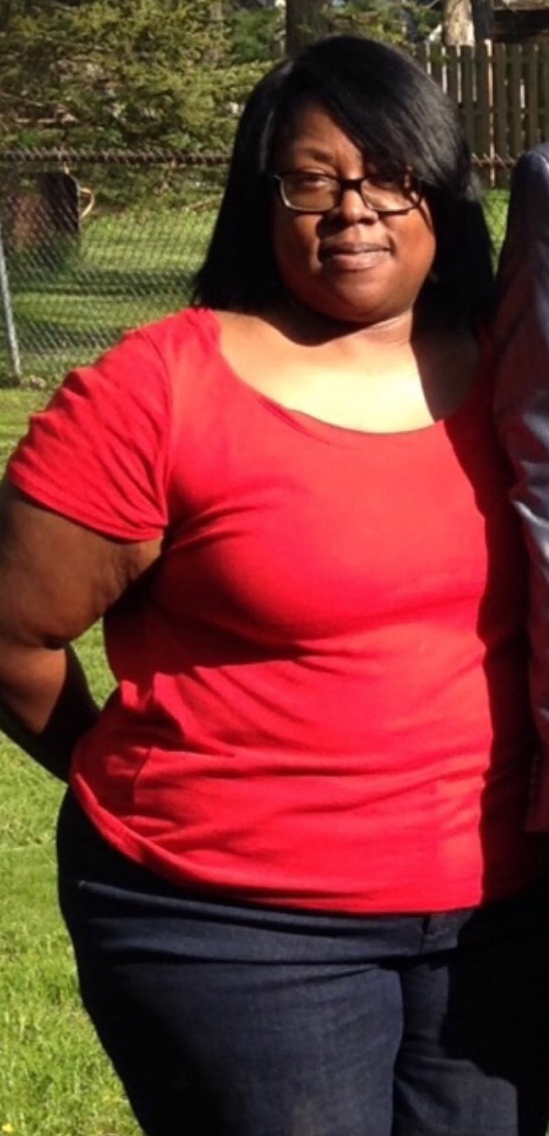 Patients 40-59 Years Old Before & After Gallery - Patient 14494459 - Image 1