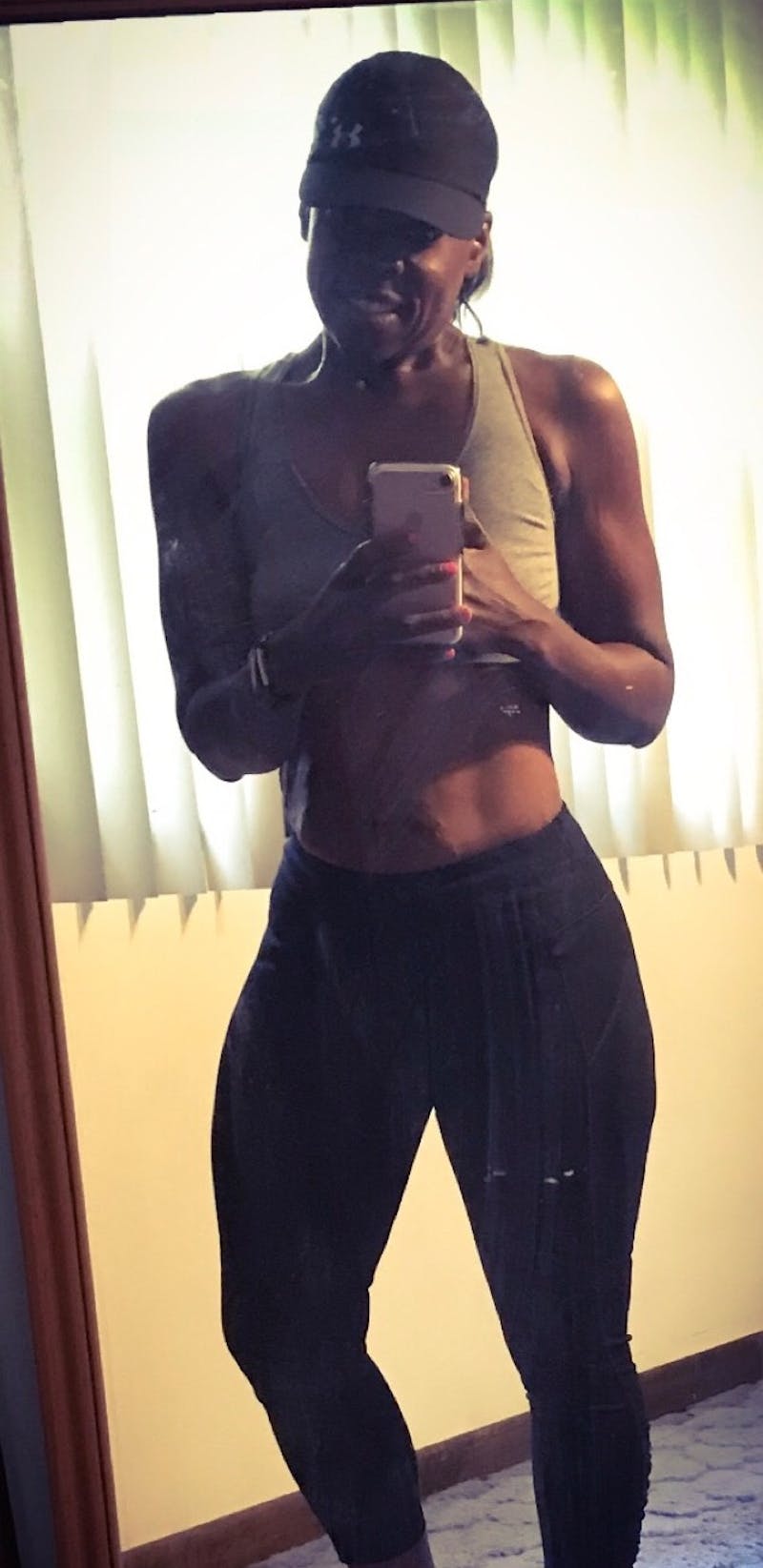 Patients 40-59 Years Old Before & After Gallery - Patient 14494459 - Image 2