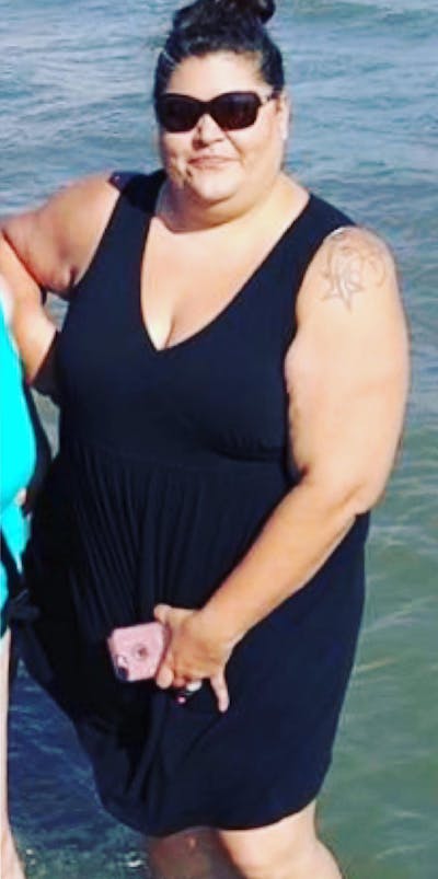 Patients 40-59 Years Old Before & After Gallery - Patient 14494460 - Image 1